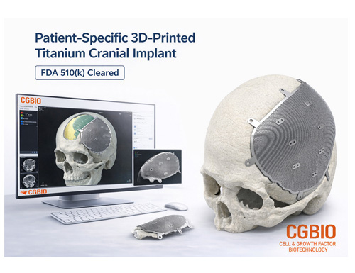 EASYMADE TI,’ a Patient-Specific Titanium Implant, Receives FDA 510(k) Clearance from CGBIO
